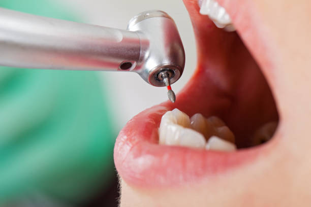 Best 24-Hour Emergency Dentist in Air Force Academy, CO